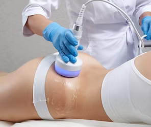 Body contouring treatment